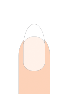 1Oval